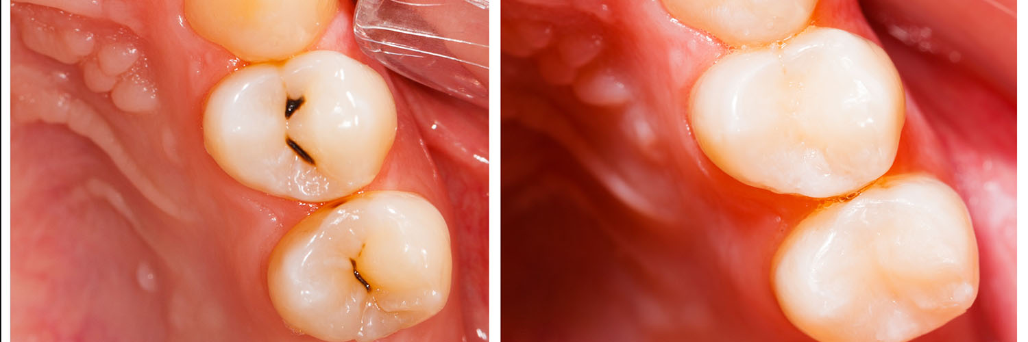 Acacia Dental Group