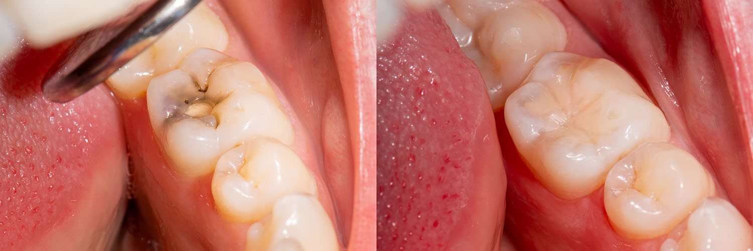 Acacia Dental Group