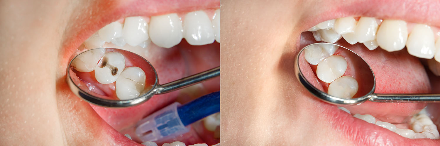 Acacia Dental Group