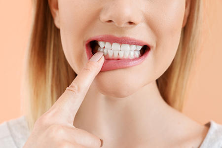 Acacia Dental Group